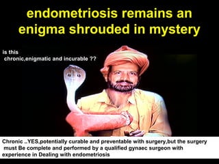 endometriosis remains an
      enigma shrouded in mystery
is this
 chronic,enigmatic and incurable ??




Chronic ..YES,potentially curable and preventable with surgery,but the surgery
 must Be complete and performed by a qualified gynaec surgeon with
experience in Dealing with endometriosis
 