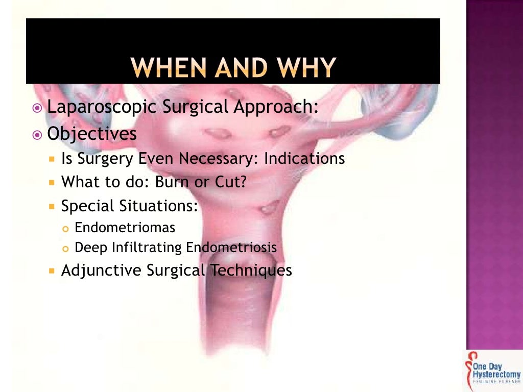 Endometriosis and laparoscopy when and how