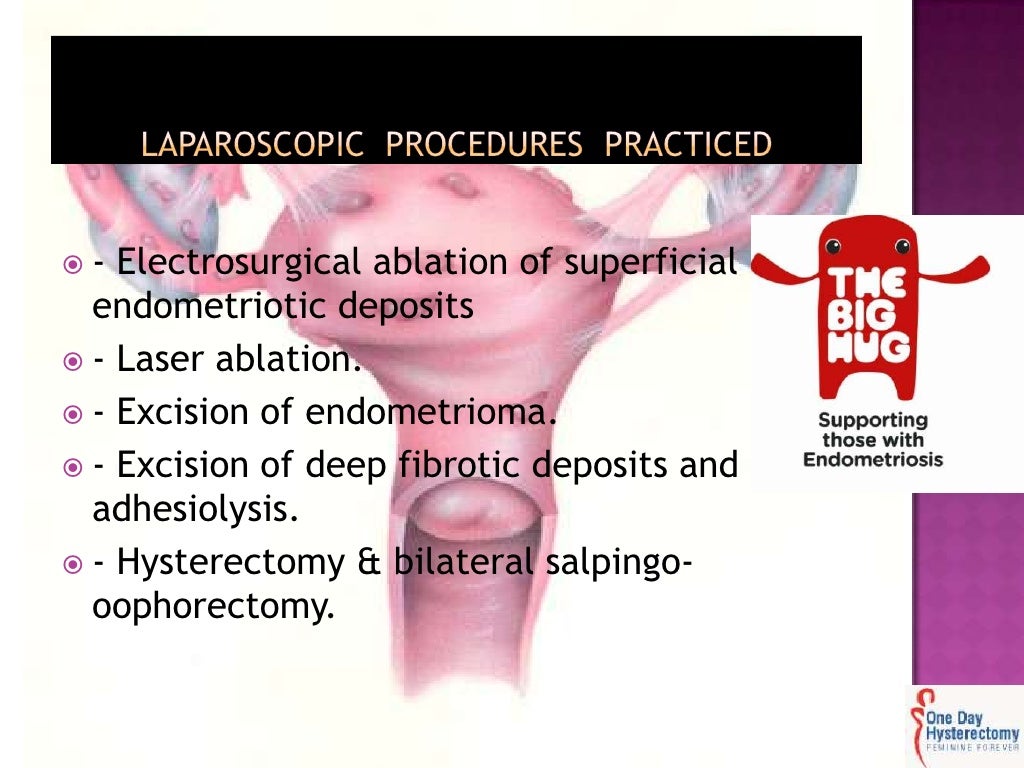 Endometriosis and laparoscopy when and how