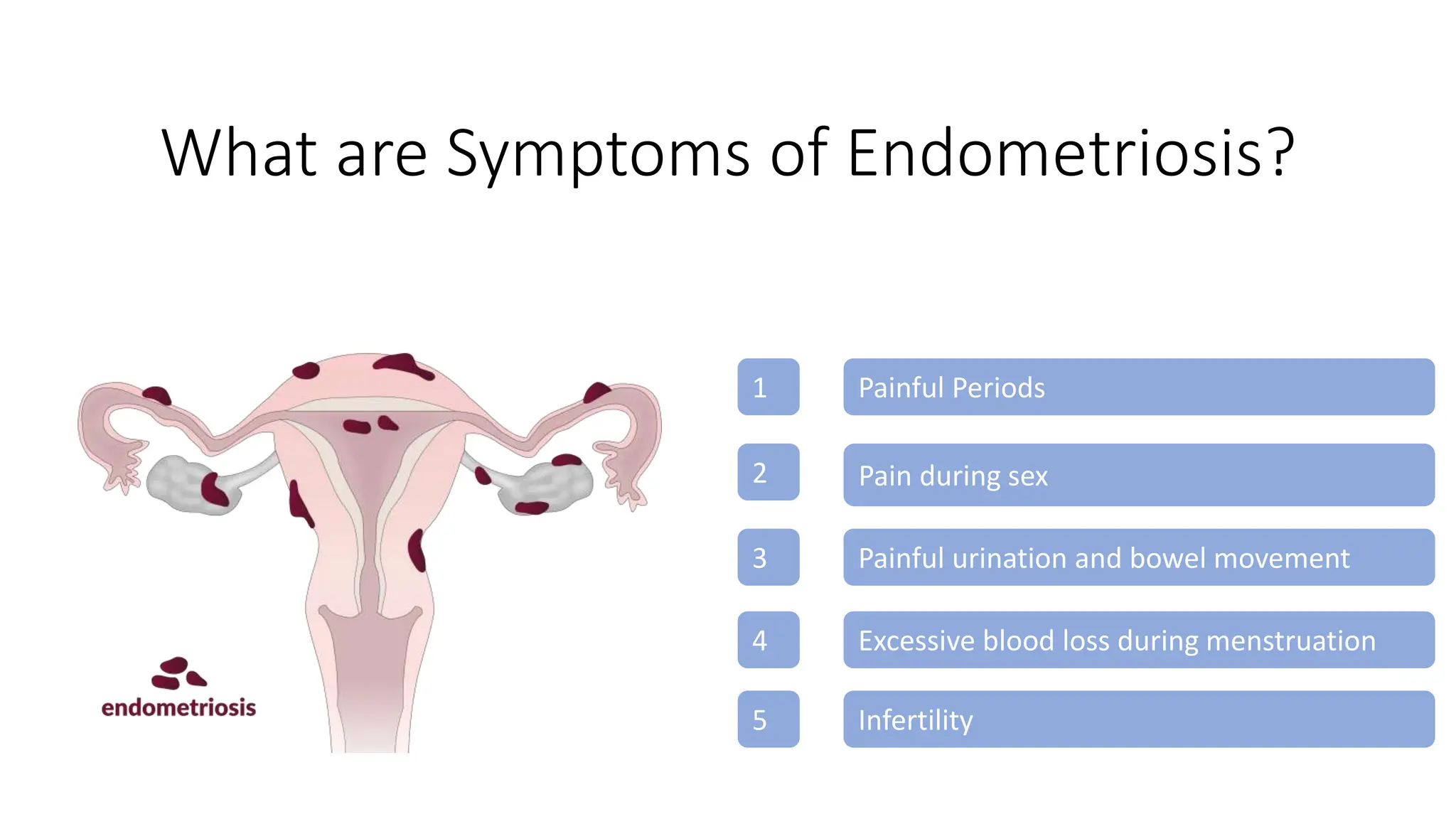 Full Archive Download Does Endometriosis Make Sex Painful
