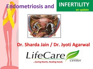 Endometriosis and
Dr. Sharda Jain / Dr. Jyoti Agarwal
…Caring Hearts, Healing hands
INFERTILITY
an update
 