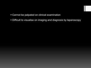  Cannot be palpated on clinical examination
 Difficult to visualise on imaging and diagnosis by laparoscopy
 
