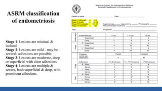Stage 1: Lesions are minimal &
isolated
Stage 2: Lesions are mild - may be
several; adhesions are possible.
Stage 3: Lesions are moderate, deep
or superficial with clear adhesions
Stage 4: Lesions are multiple &
severe, both superficial & deep, with
prominent adhesions.
ASRM classification
of endometriosis
 