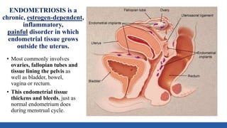 ENDOMETRIOSIS is a
chronic, estrogen-dependent,
inflammatory,
painful disorder in which
endometrial tissue grows
outside the uterus.
• Most commonly involves
ovaries, fallopian tubes and
tissue lining the pelvis as
well as bladder, bowel,
vagina or rectum.
• This endometrial tissue
thickens and bleeds, just as
normal endometrium does
during menstrual cycle.
 