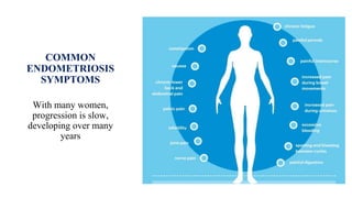 COMMON
ENDOMETRIOSIS
SYMPTOMS
With many women,
progression is slow,
developing over many
years
 