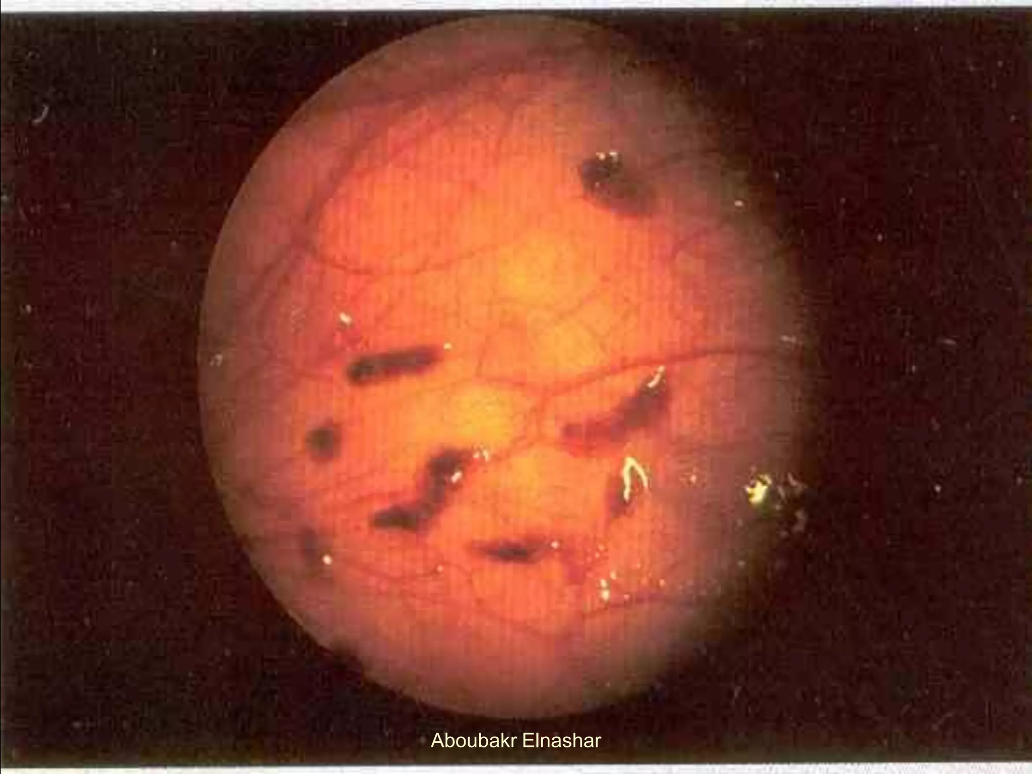 Aboubakr Elnashar
 