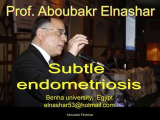 Benha university, Egypt
elnashar53@hotmail.com
Aboubakr Elnashar
 