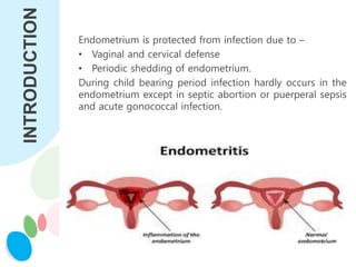 INTRODUCTION Endometrium is protected from infection due to –
• Vaginal and cervical defense
• Periodic shedding of endometrium.
During child bearing period infection hardly occurs in the
endometrium except in septic abortion or puerperal sepsis
and acute gonococcal infection.
 