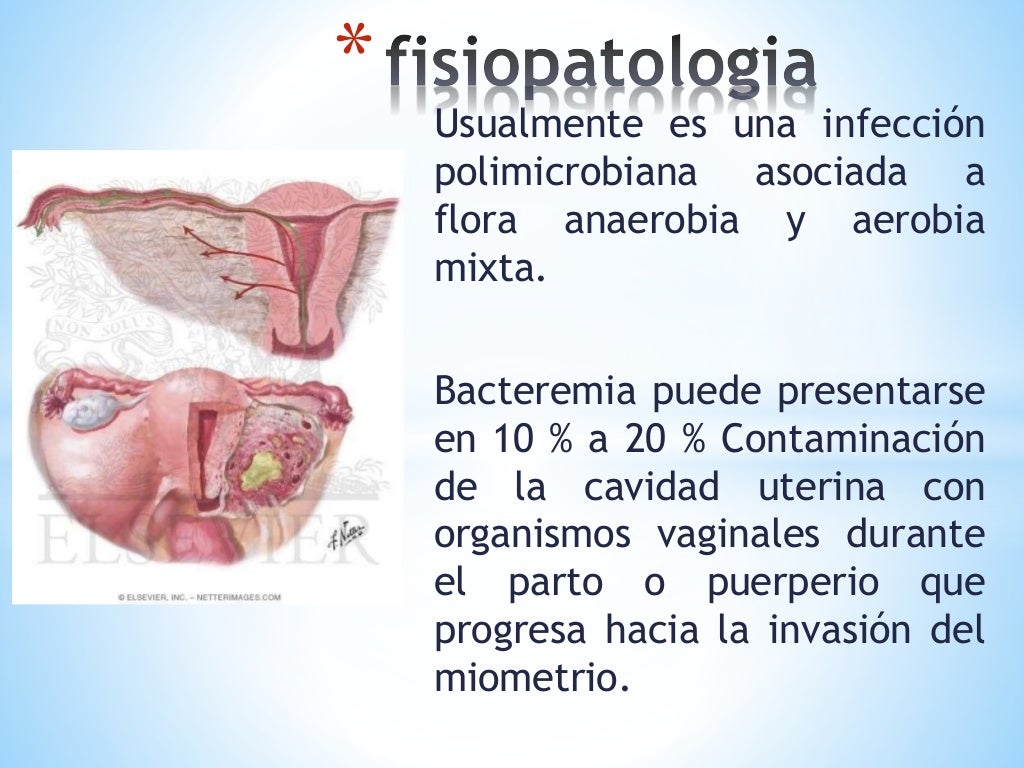 Endometritis puerperal