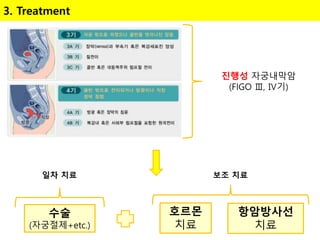 3. Treatment
진행성 자궁내막암
(FIGO Ⅲ, Ⅳ기)
수술
(자궁절제+etc.)
호르몬
치료
항암방사선
치료
일차 치료 보조 치료
 
