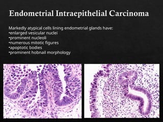 Comprehensive Overview of Endometrial Cycle and Hyperplasia Pathology | PPT