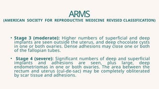 Comprehensive Overview and Classification of Endometriosis | PPTX