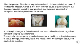Direct exposure of the dental pulp to the oral cavity is the most obvious route of
endodontic infection. Caries is the most common cause of pulp exposure, but
bacteria may also reach the pulp via direct pulp exposure as a result of
iatrogenic restorative procedures or trauma
to pathologic changes in these tissues It has been claimed that microorganisms
can reach the pulp by anachoresis .
Theoretically, microorganisms can be transported in the blood or lymph to an area
of tissue damage, where they leave the vessel, enter the damaged tissue, and
establish an infection
 