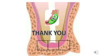 Endo microbiology bm