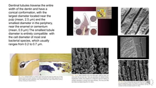 Dentinal tubules traverse the entire
width of the dentin and have a
conical conformation, with the
largest diameter located near the
pulp (mean, 2.5 µm) and the
smallest diameter in the periphery,
near the enamel or cementum
(mean, 0.9 µm) The smallest tubule
diameter is entirely compatible with
the cell diameter of most oral
bacterial species, which usually
ranges from 0.2 to 0.7 µm.
 