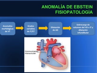 ANOMALÍA DE EBSTEIN
                               FISIOPATOLOGÍA

                                               Sobrecarga de
 Anomalías      Grados
                              Dilatación   volumen del VD x IT y
morfológicas   variables
                                de AD            dilatación
   de VT       de IT/ET
                                                infundibular
 