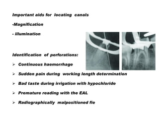 Important aids for locating canals
-Magnification
- illumination

Identification of perforations:
 Continuous haemorrhage
 Sudden pain during working length determination
 Bad taste during irrigation with hypochloride
 Premature reading with the EAL
 Radiographically malpositioned fie

 