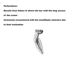 Perforations:

Results from failure to direct the bur with the long access
of the crown
Commonly encountered with the mandibular anteriors due

to their inclination

 