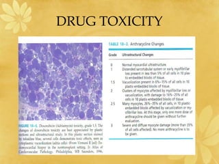 DRUG TOXICITY
 