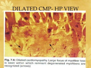 DILATED CMP- HP VIEW
 