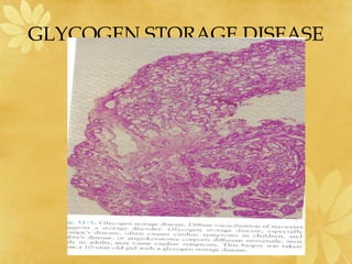 GLYCOGEN STORAGE DISEASE
 