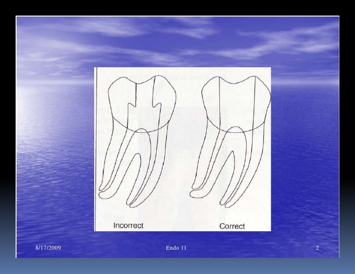 Endo note 11 peparation of curved root canal