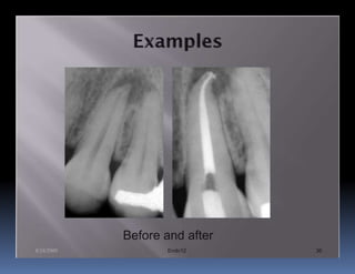 Before and after
8/24/2009          Endo12      36
 