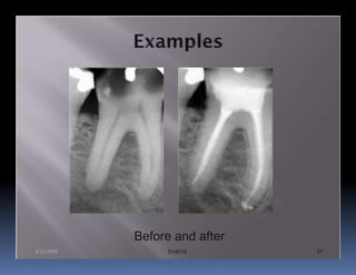 Before and after
8/24/2009         Endo12       37
 