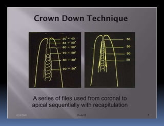 A series of files used from coronal to
            apical sequentially with recapitulation
8/24/2009                     Endo12                  7
 