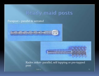Pre Tapped Posts Endo note 16 restoration of root filled | PPTX