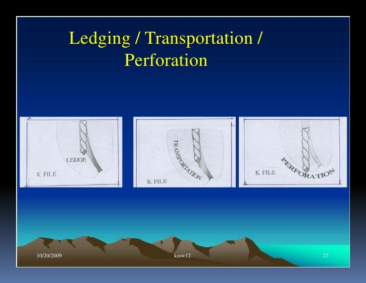 Endo note 17 problem solving in endodontics