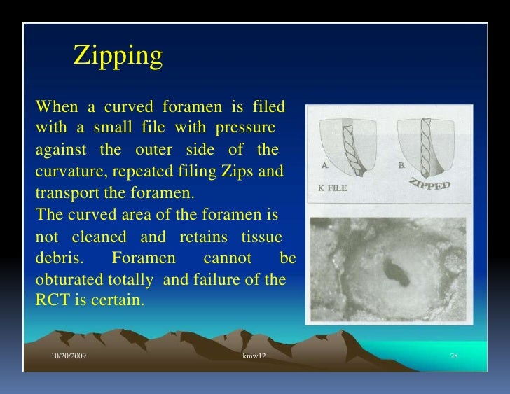 Endo note 17 problem solving in endodontics