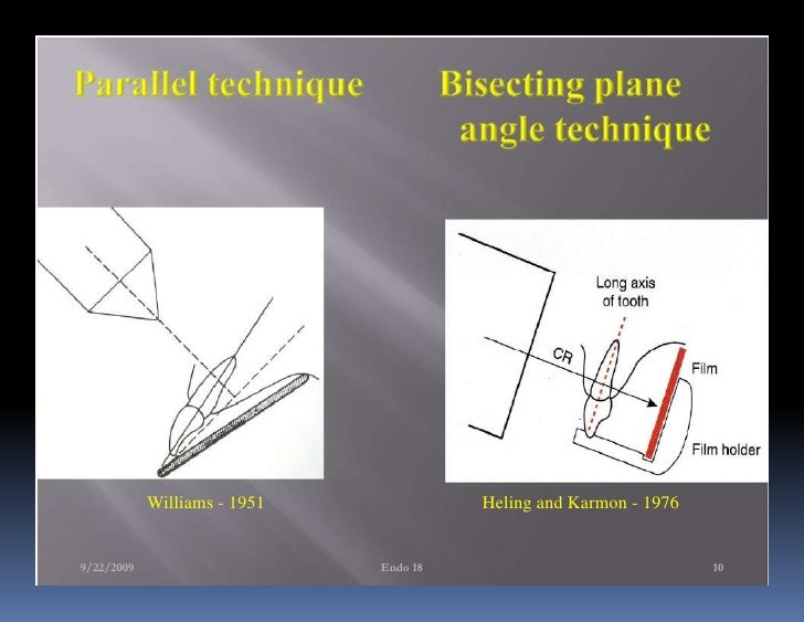 Endo note 18 ledge formation