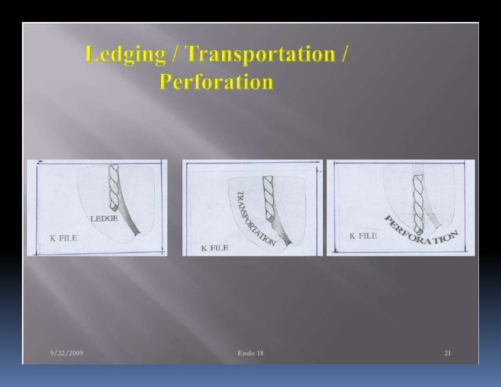 Endo note 18 ledge formation