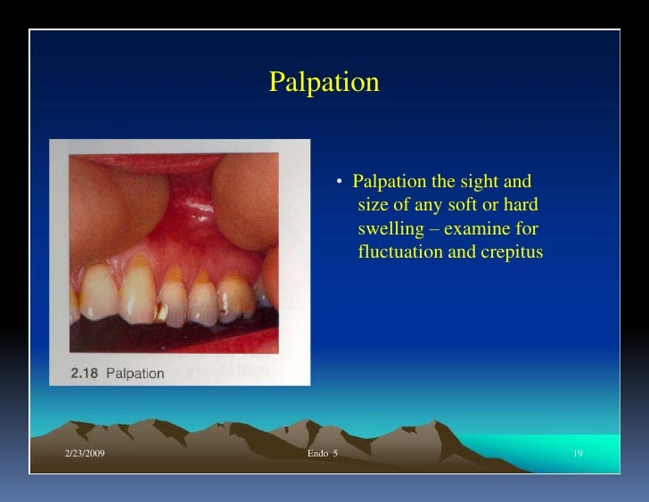 Endo note 5 examination
