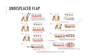 UNDISPLACED FLAP
 