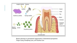 Recent advances in periodontal regeneration: A biomaterial perspective
Yongxi Liang, Xianghong Luan, and Xiaohua Liua
 