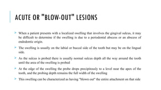 ACUTE OR "BLOW-OUT" LESIONS
 When a patient presents with a localized swelling that involves the gingival sulcus, it may
be difficult to determine if the swelling is due to a periodontal abscess or an abscess of
endodontic origin.
 The swelling is usually on the labial or buccal side of the tooth but may be on the lingual
side.
 As the sulcus is probed there is usually normal sulcus depth all the way around the tooth
until the area of the swelling is probed
 At the edge of the swelling the probe drops precipitously to a level near the apex of the
tooth, and the probing depth remains the full width of the swelling
 This swelling can be characterized as having "blown out" the entire attachment on that side
 