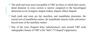  The teeth and roots most susceptible to VRF are those in which their mesio-
distal diameter in cross section is narrow compared to the buccolingual
dimension (oval, hourglass shaped, kidney shaped, ribbon shaped).
 Such teeth and roots are the maxillary and mandibular premolars, the
mesial root of mandibular molars, the mandibular anterior teeth, and mesio-
buccal roots of the maxillary molars
 One of the most frequent bony radiolucencies seen around VRF teeth
radiographic feature of VRF is the “halo” (“J shaped”) appearance.
 