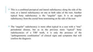  This is a combined periapical and lateral radiolucency along the side of the
root, or a lateral radiolucency on one or both sides of the root. Another
typical bony radiolucency is the “angular” type. It is an angular
radiolucency from the crestal bone terminating on the side of the root
 The “angular” radiolucency is more often typical in a case with a “true”
periodontal disease, but as in the previous more “typical” bony
radiolucencies of a VRF tooth, it is only the presence of the
“pathognomonic combination” of clinical signs and symptoms that will
confirm the diagnosis
 