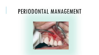PERIODONTAL MANAGEMENT
 