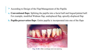  According to Design of the Flap/Management of the Papilla
a. Conventional flaps: Splitting the papilla into a facial half and lingual/palatal half.
For example, modified Widman flap, undisplaced flap, apically-displaced flap
b. Papilla preservation flaps: Entire papilla is incorporated into one of the flaps
 