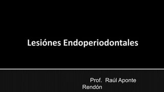 Saber Endo
Colegio de Odontólogos de Carabobo

Prof. Raúl Aponte
Rendón

 