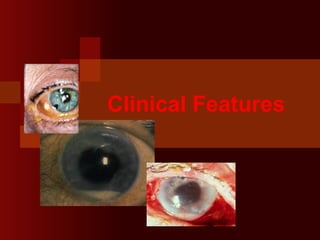 Clinical Features
 