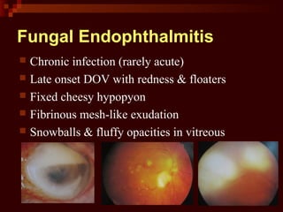 Fungal Endophthalmitis
 Chronic infection (rarely acute)
 Late onset DOV with redness & floaters
 Fixed cheesy hypopyon
 Fibrinous mesh-like exudation
 Snowballs & fluffy opacities in vitreous
 