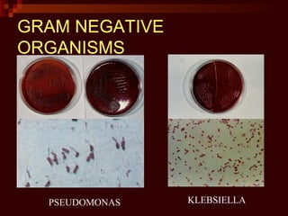 GRAM NEGATIVE
ORGANISMS
PSEUDOMONAS KLEBSIELLA
 