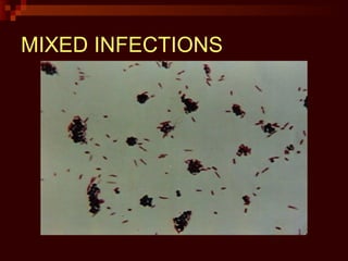 MIXED INFECTIONS
 