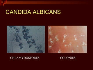 CHLAMYDOSPORES
CANDIDA ALBICANS
COLONIES
 