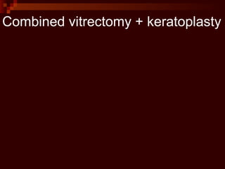 Combined vitrectomy + keratoplasty
 