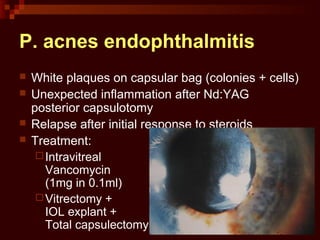P. acnes endophthalmitis
 White plaques on capsular bag (colonies + cells)
 Unexpected inflammation after Nd:YAG
posterior capsulotomy
 Relapse after initial response to steroids
 Treatment:
 Intravitreal
Vancomycin
(1mg in 0.1ml)
 Vitrectomy +
IOL explant +
Total capsulectomy
 
